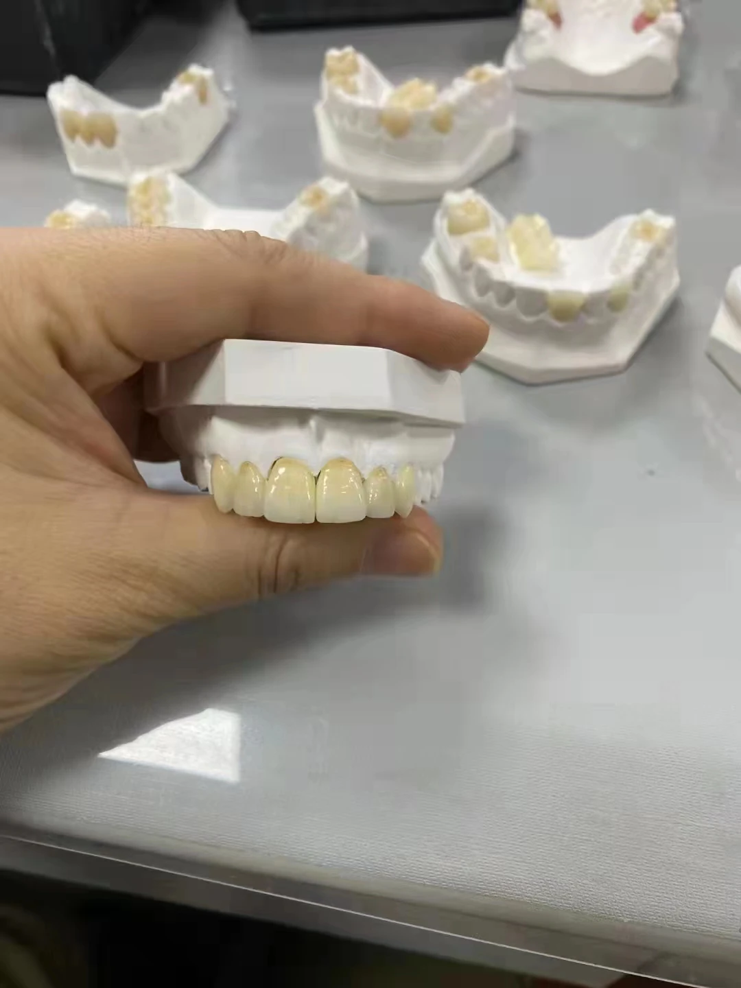 Landent Zirconia Blocks Dental Ceramic Zirconia White Disc 98mm For Cad Cam Digital Lab zirconia dental