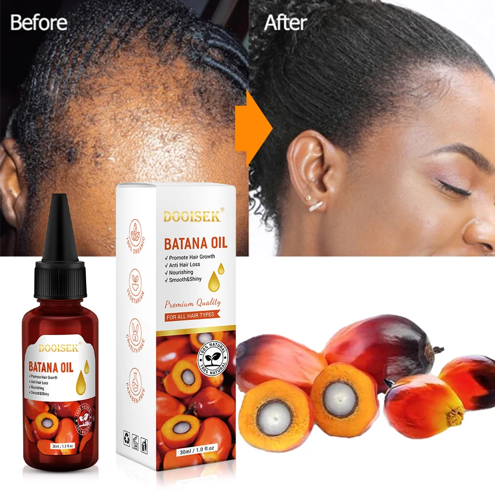 Factory Latest Hair Adivasi Batana Oil Alopecia Treatment Damaged Hair Regrowth Pousse Cheveux Hair Restoration Oil