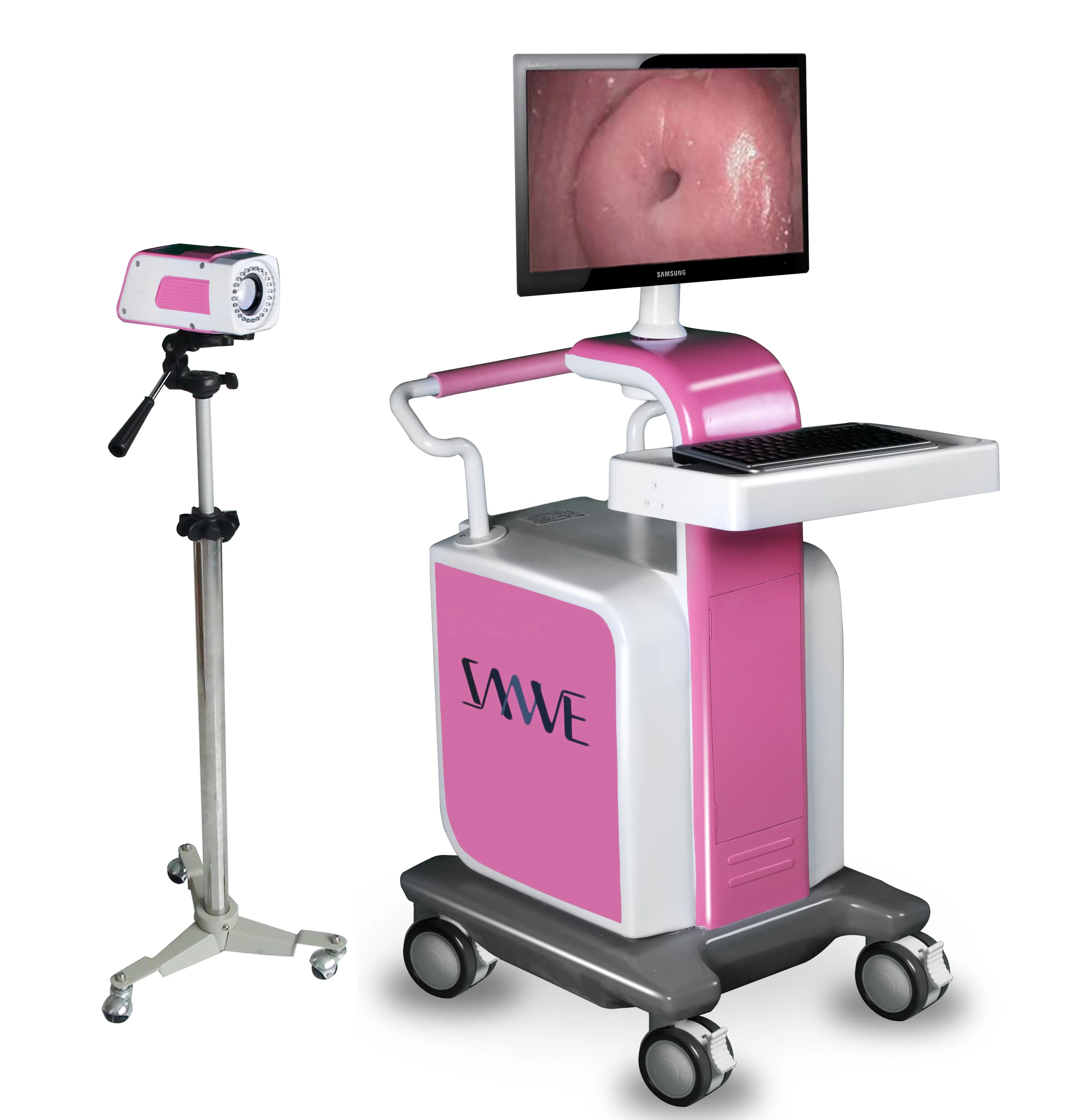 Digital Optical Colposcope  Digital Electronic Colpscope  Trolley Vaginal Colposcope