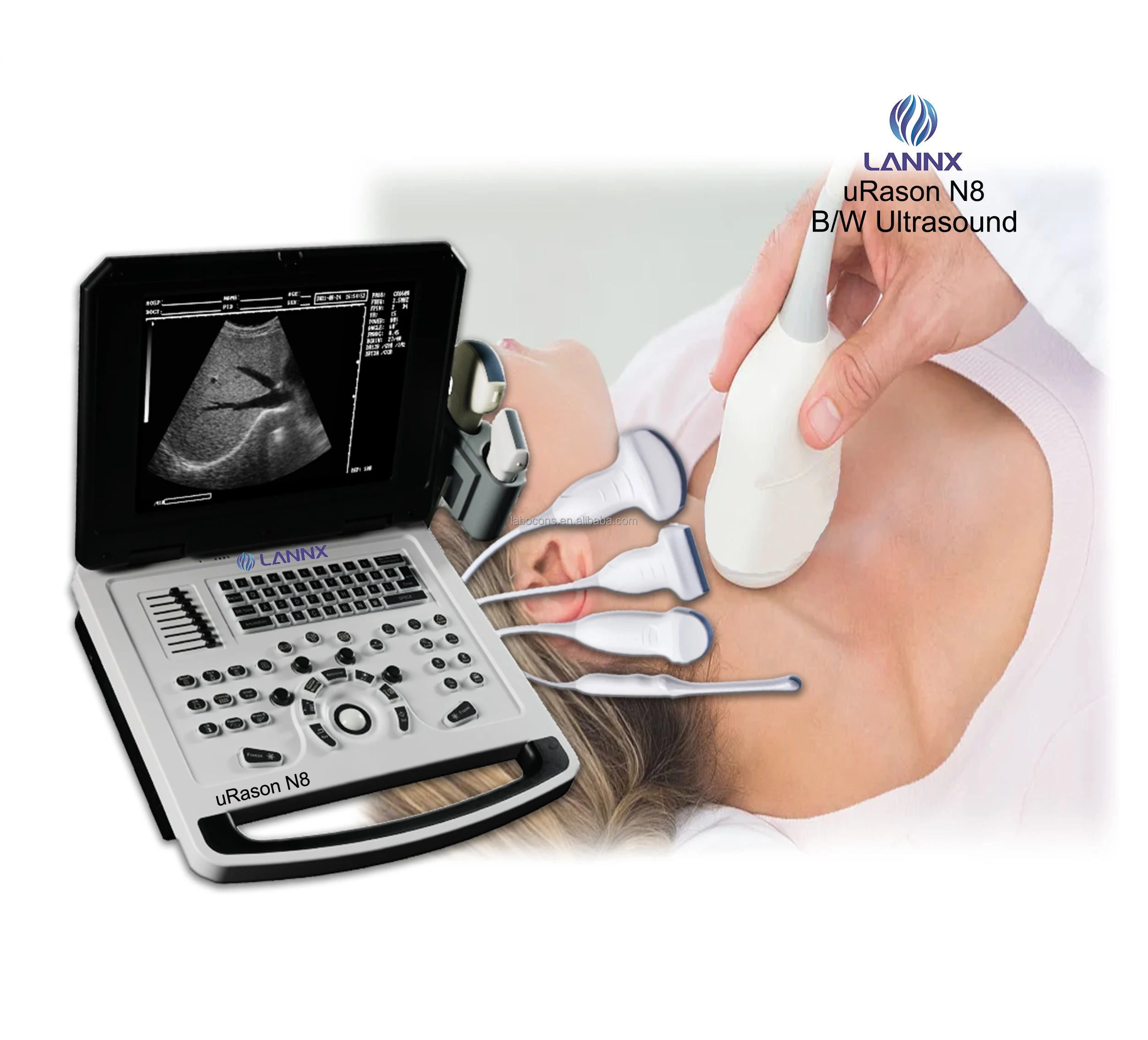 LANNX uRason N8 Most Popular black\white Portable Ultrasound Scanner ecografia portatil Hand Carried Laptop ultrasonido device