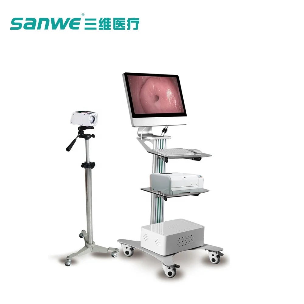 sanwe SW-3302 Digital Electronic colposcope/cheap Vagina examination colposcopy