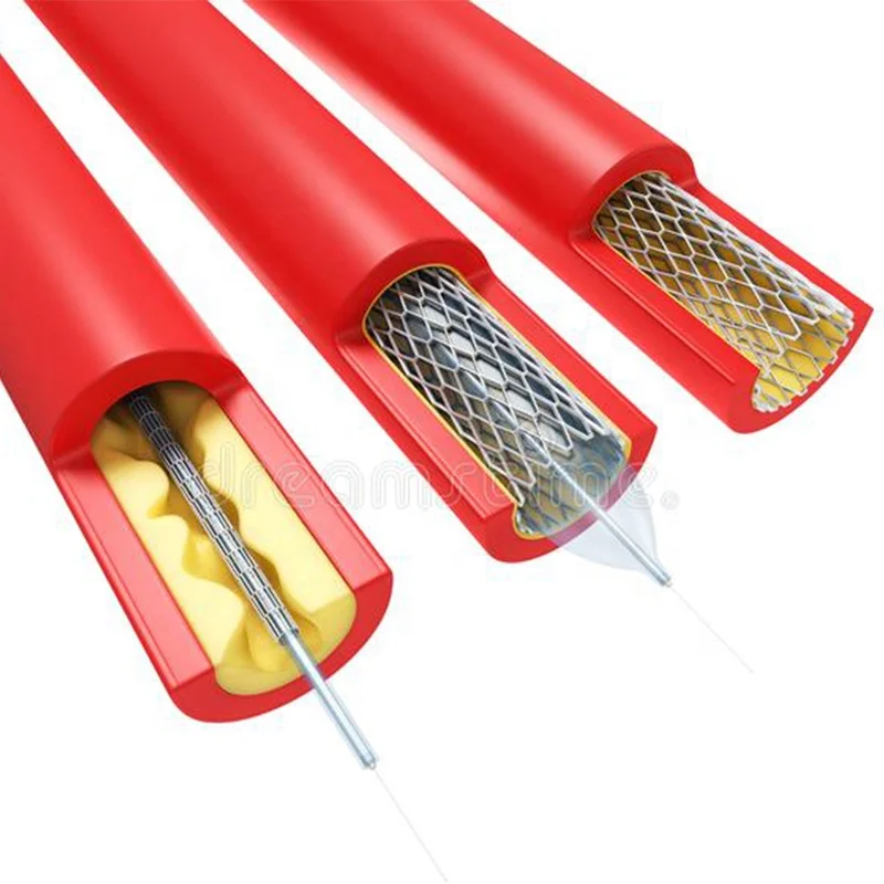 Hot Selling Disposable Medical Coronary Stent Balloon Catheters ISO Qualified Balloon Catheters