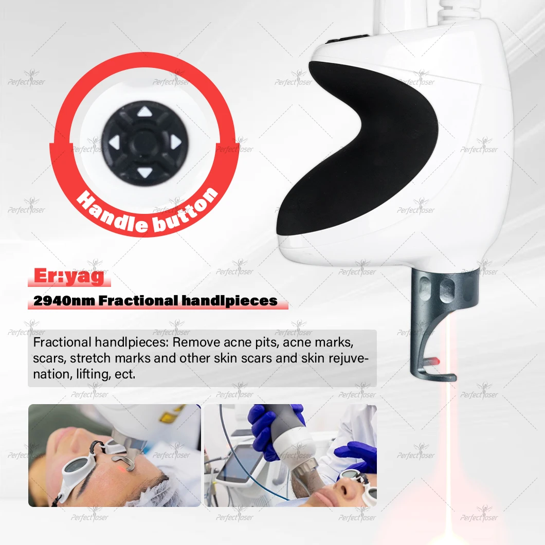 ODM Fraccionado Fractional Face Machine Fotona 4d Dermatology Equipment Erbium Wart Co2 Laser