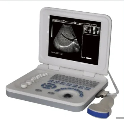 Portable Black and White Ultrasound Best Price China Medical Ultrasound Scanner portable ultrasound price