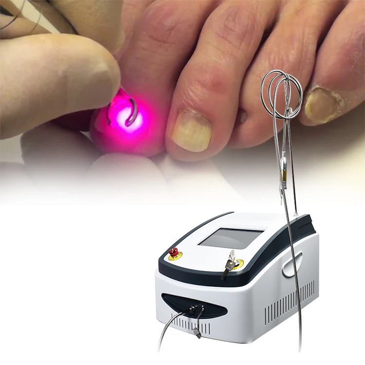 2024 Hot Sale 980nm Diode Laser Podiatry Physical Therapy Equipment Pain Relief Diode Laser Treatment for Onychomycosis