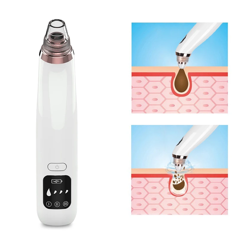 5 Head Pore Cleanser Vacuum Electric Suction Facial Comedo Acne Remover Extractor Tool Kit Blackhead Remover Vacuum