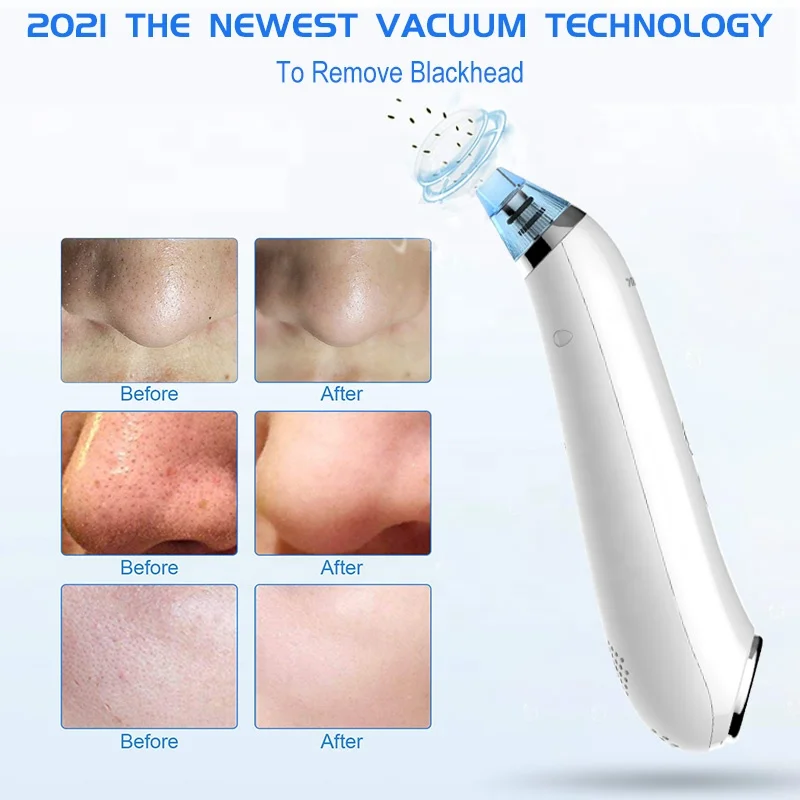 
Personal Skin Care Pore Cleaner Comedo Blackhead Vacuum Remover Kit Extractor For Nose and Face 