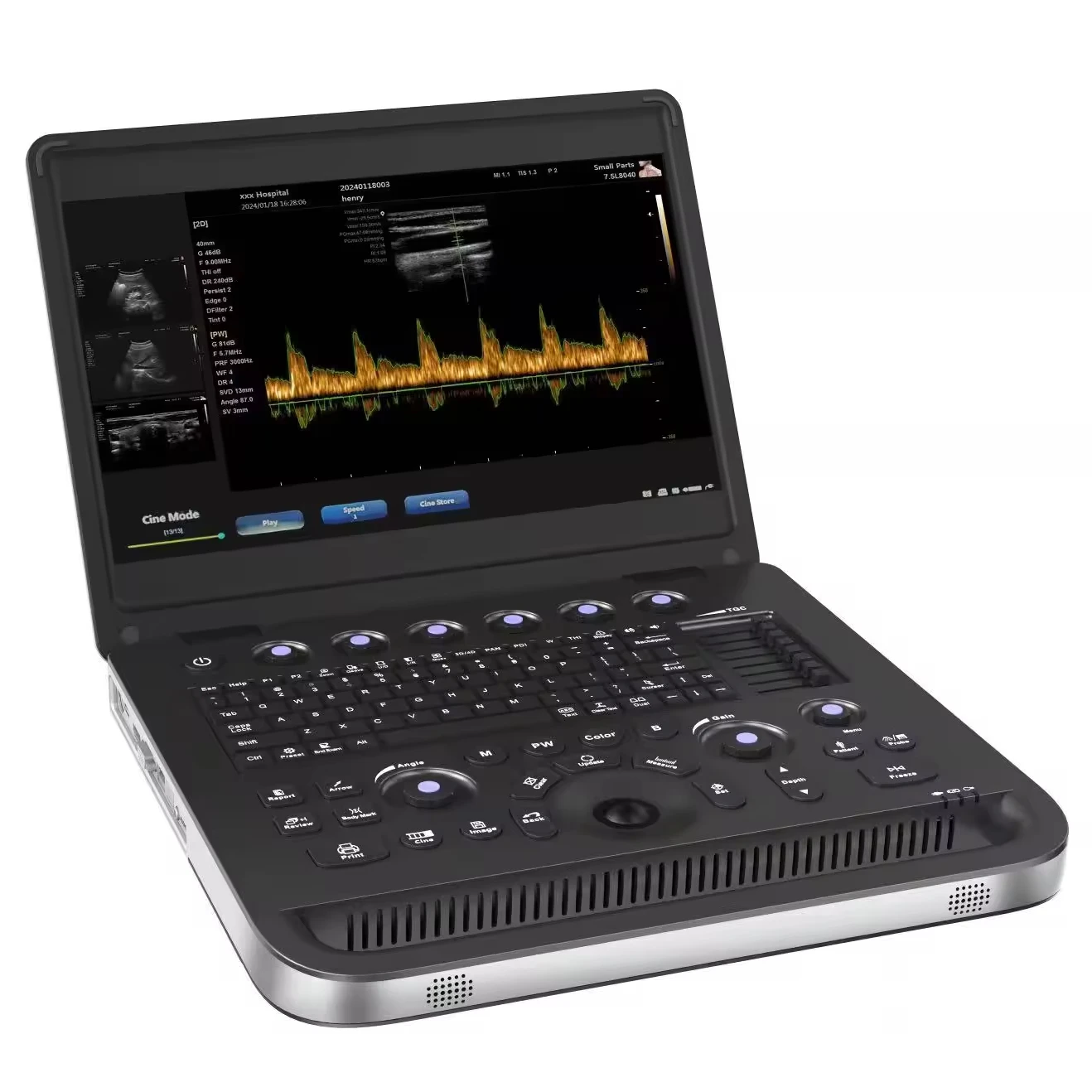 15.6 inch big screen laptop color doppler ultrasound have 3D software and cheapest price
