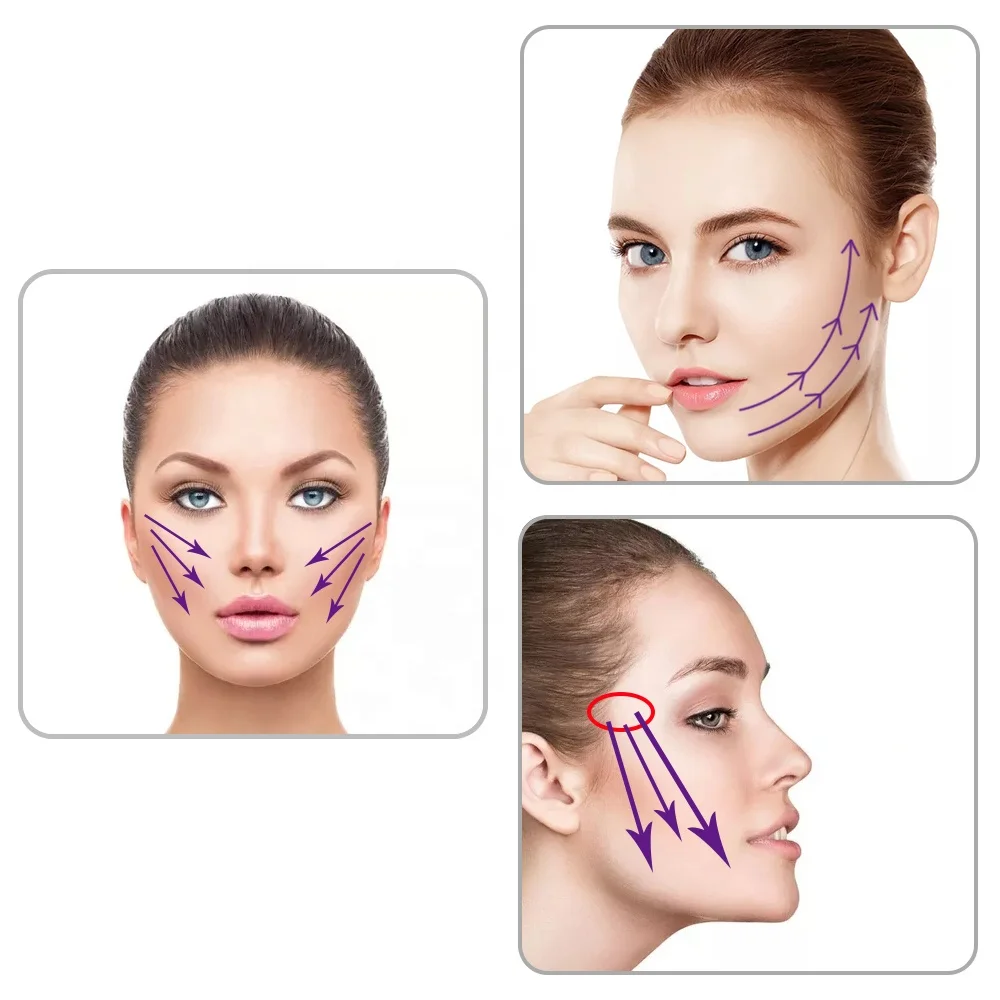 Cosmetic Grade No Pain 18G 100mm 3d Cog Blunt L Needle Type Hilos Tensores Pdo Thread