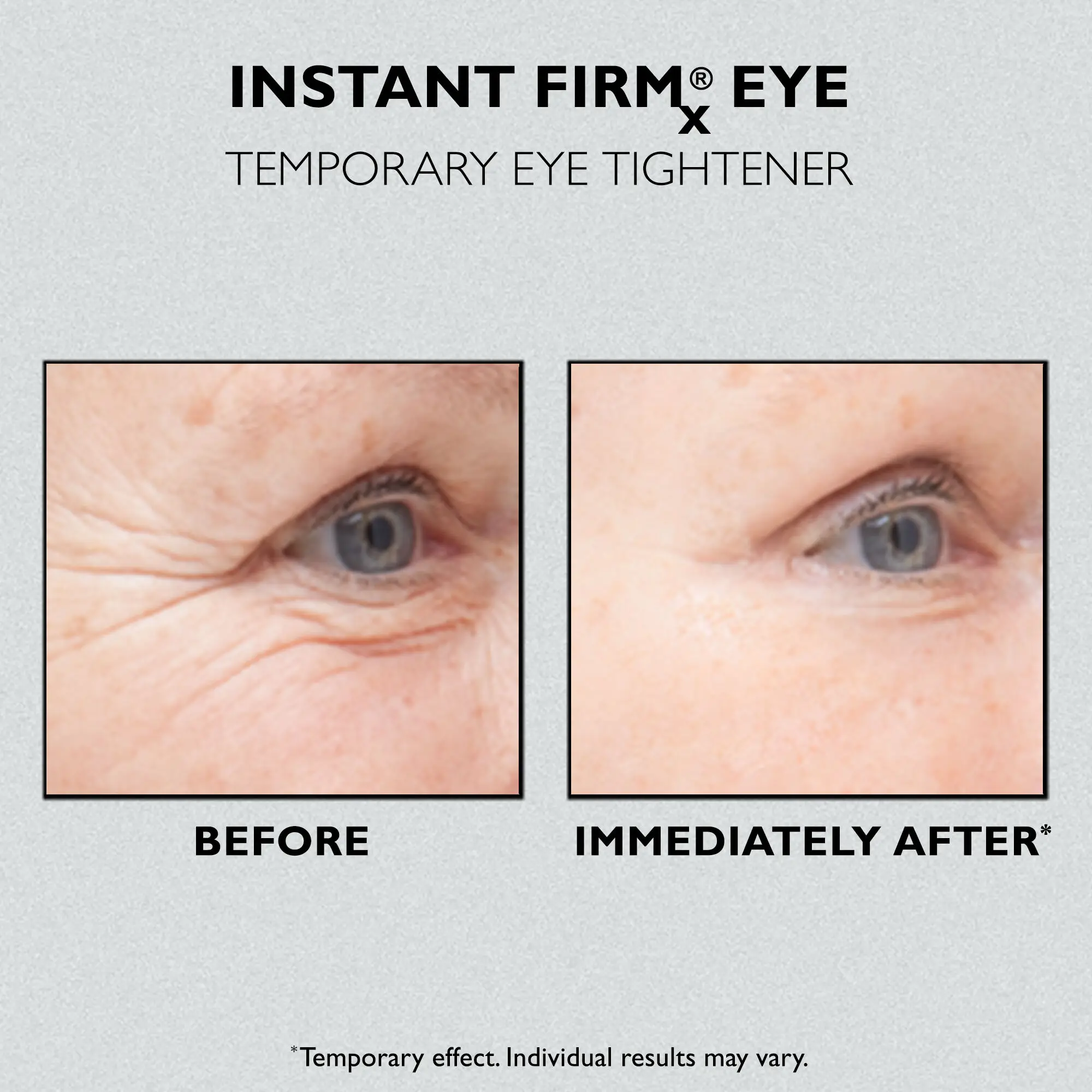 Private Label Custom Anti-Aging Eye Lift Cream Removal Dark Circles Bags Puffiness Instant Eye Tightening Cream