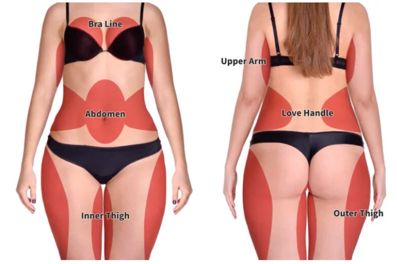 Assisted Surgical Liposuction 1064nm lift face endolaser Optic Fibers Laser Lipolysis Laser Diode1064 Nm Surgery Plastic
