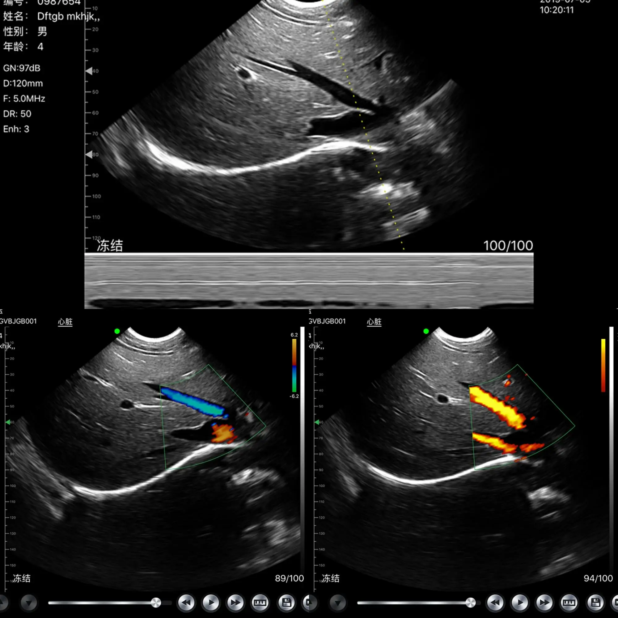 
konted c10T three in one wireless color doppler ultrasound with needle biopsy guide probe 