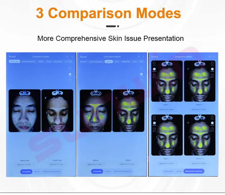2024 AI Intelligent Imager 8 Spectral Imaging AI Skin Analyzer Skin Scanner Machine With Microscopic Hand Tool