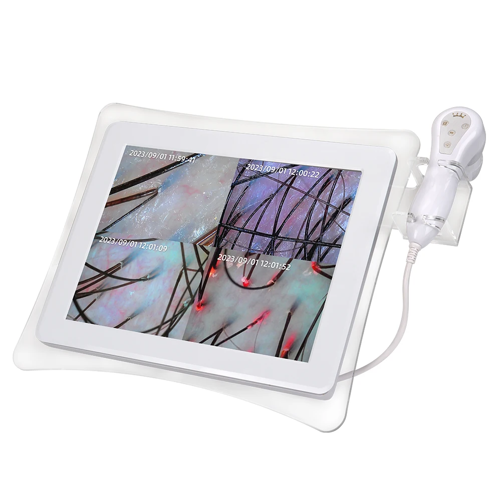 analyzer skin skin analyzer camera