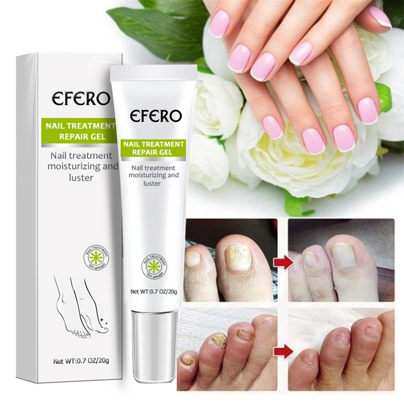 EFERO Herbal Nail Repair Cream Gel Feet Care Anti Infection Onychomycosis Fungal Nail Treatment Cream