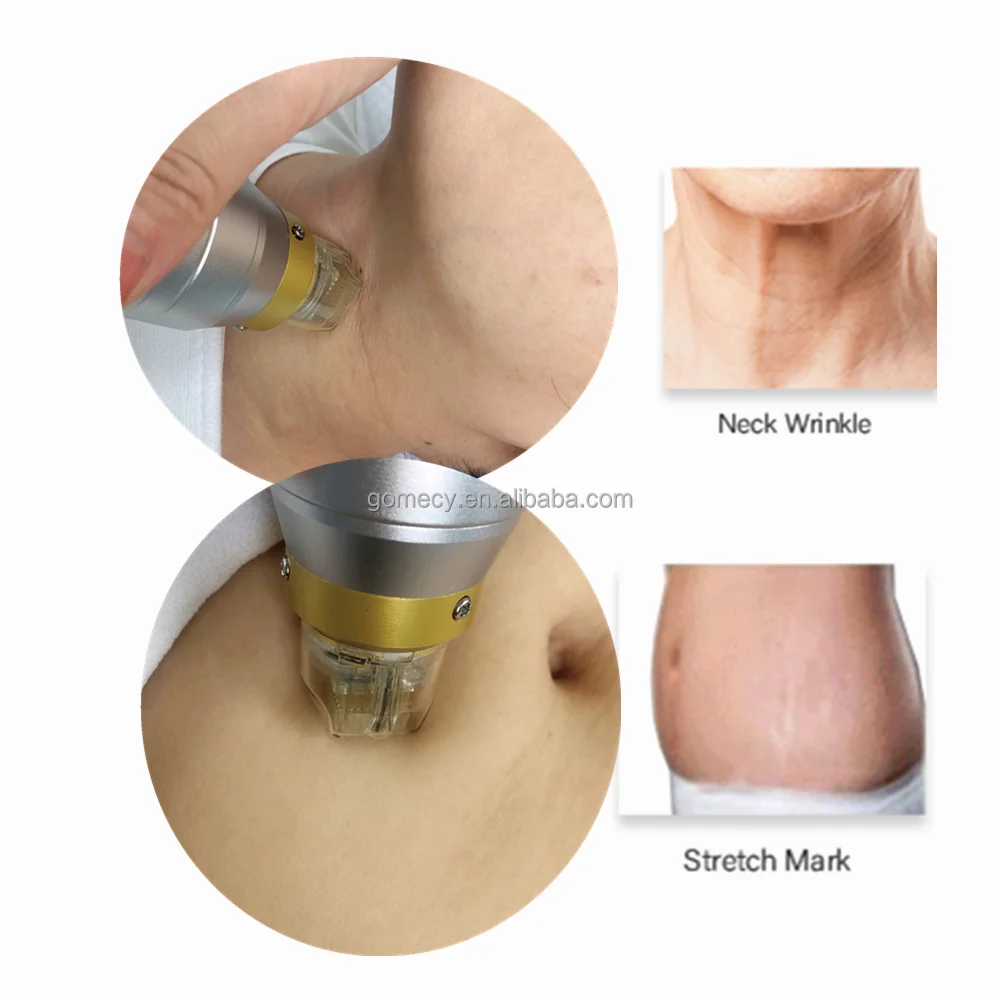 2024  CE Microneedle Fraction R Microneedle Fractional Machine/Micro Needle Fractional R Face Lifting Machine