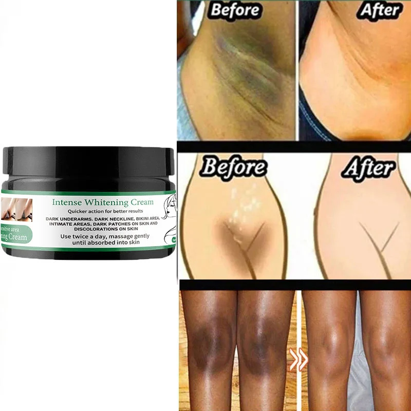 OEM Body Whitening Cream Underarm Legs Knee Elbow Private Parts Brighten Armpit Bleaching Cream Remove Dark Spots Skin Care