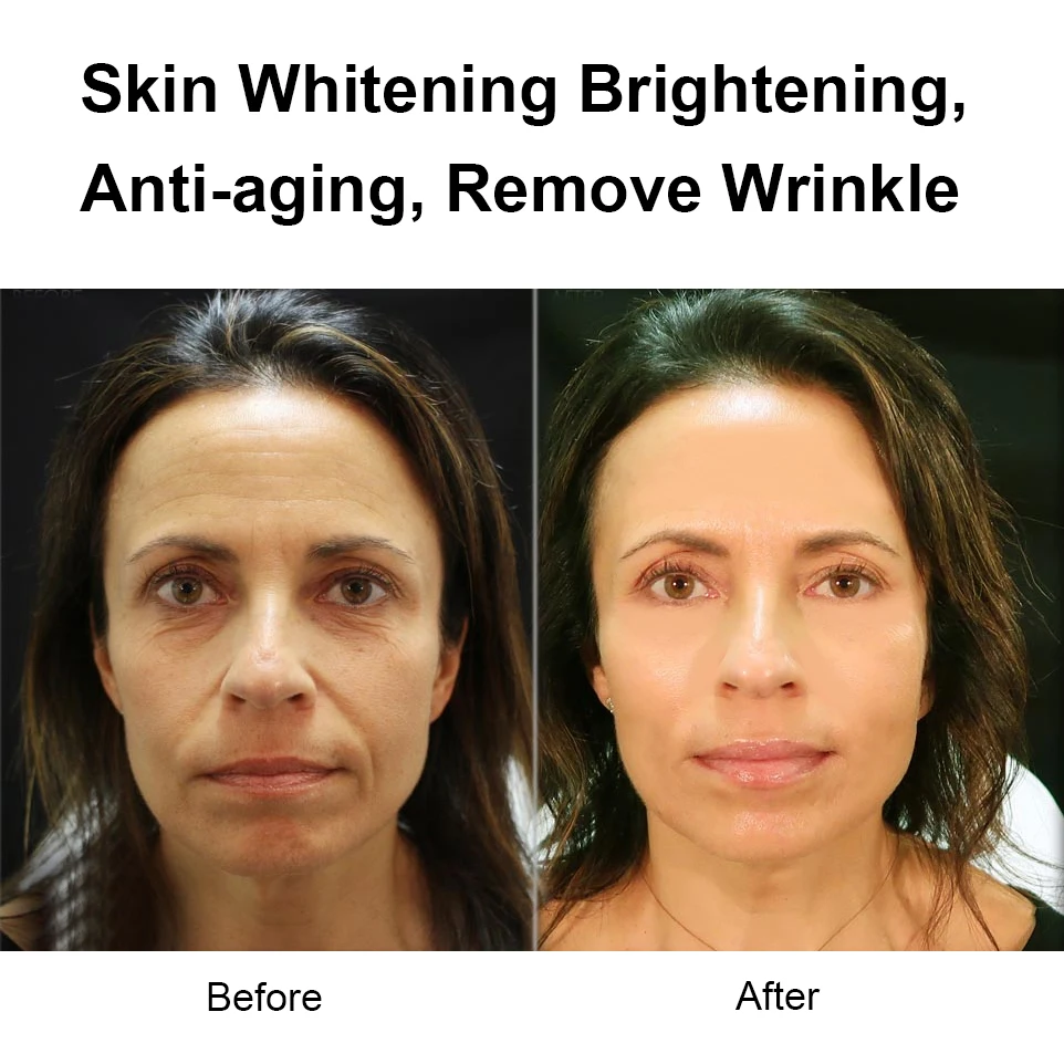 Glutathione Skin Whitening Gluta Papaya Serum Remove Spots Pigmentation skincare beauty serum for half cast skin whitening