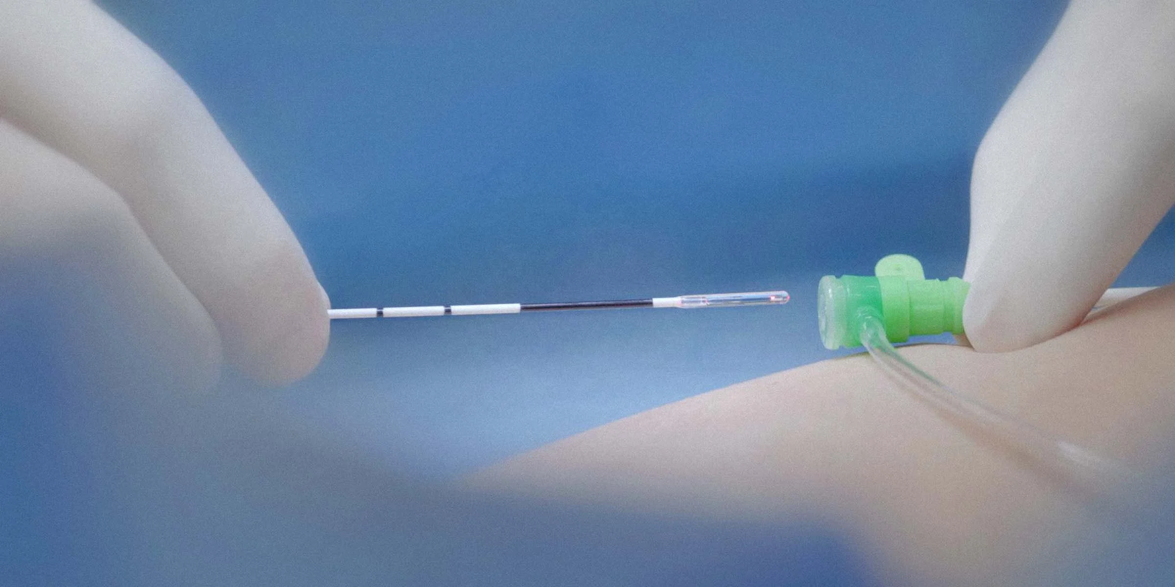 Surgery lipolysis face lift endolaser bare fiber evlt radial fiber hemorrhoid fistula fiber