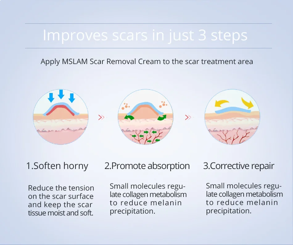 striae gravidarum cream