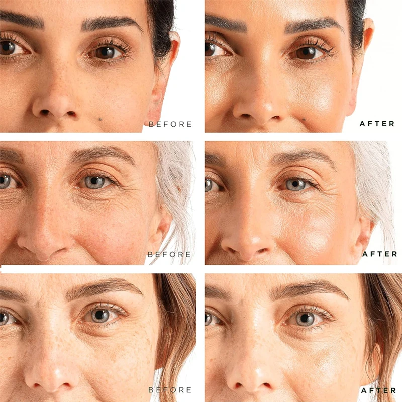 Skin Care Face Serum Private Label Anti-wrinkle Cosmetics Anti Aging Vitamin C Niacinamide Hyaluronic Acid Whitening Serum