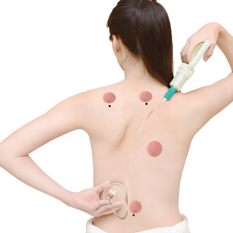 12-Cup Chinese Medical Myofascial Cupping Set with Different Sizes featuring Suction Technology