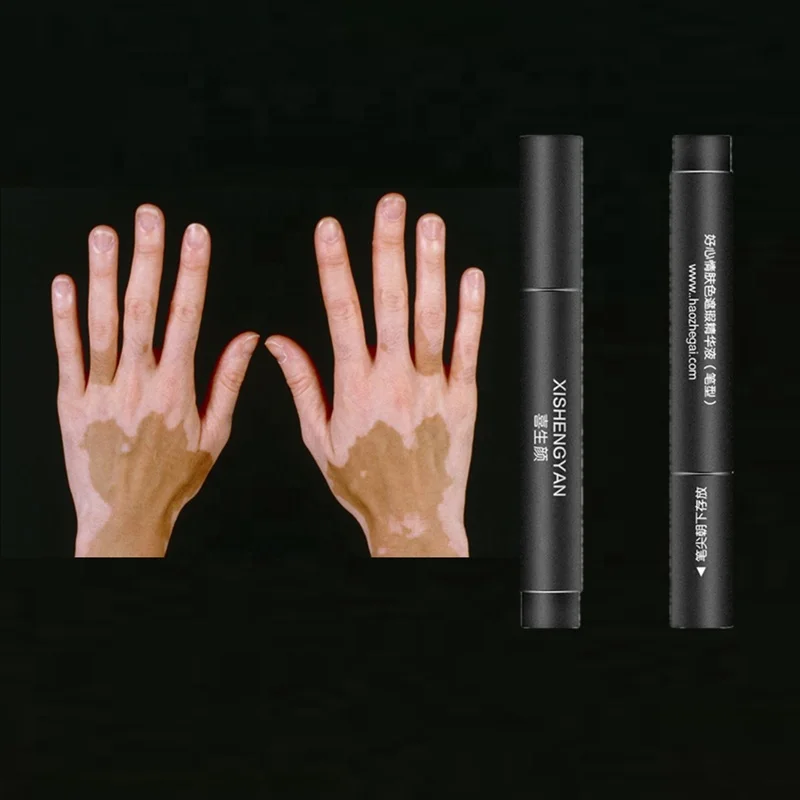 Retail Face Body White Spot Cosmetic Cream Pen Lasting Patches Makeup Waterproof Cover Concealer Vitiligo for Women Men