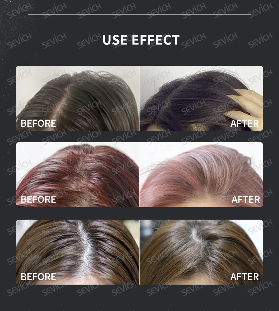 Sevich Hot Selling Hair Styling Powder Natural Volume Powder Matte Powder Hair Strong Holding Increases Hair Volume