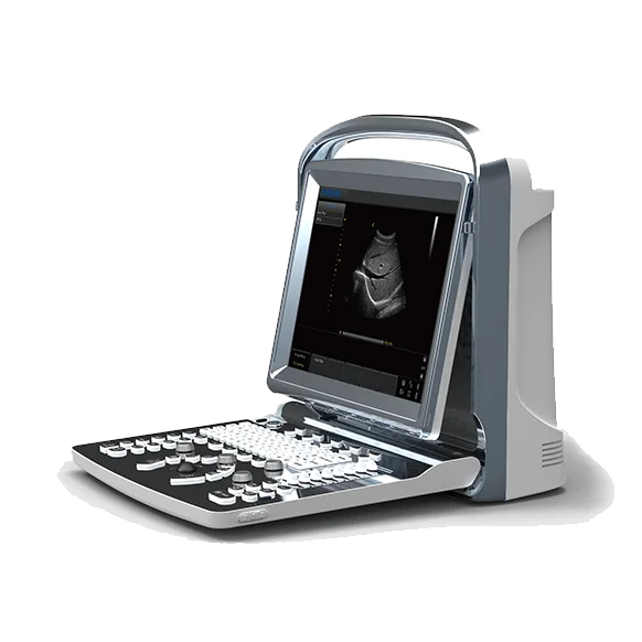 Chison Eco1 Black and white portable Ultrasound Scanner Echo1 veterinary ultrasound Machine  Diagnostic ultrasound