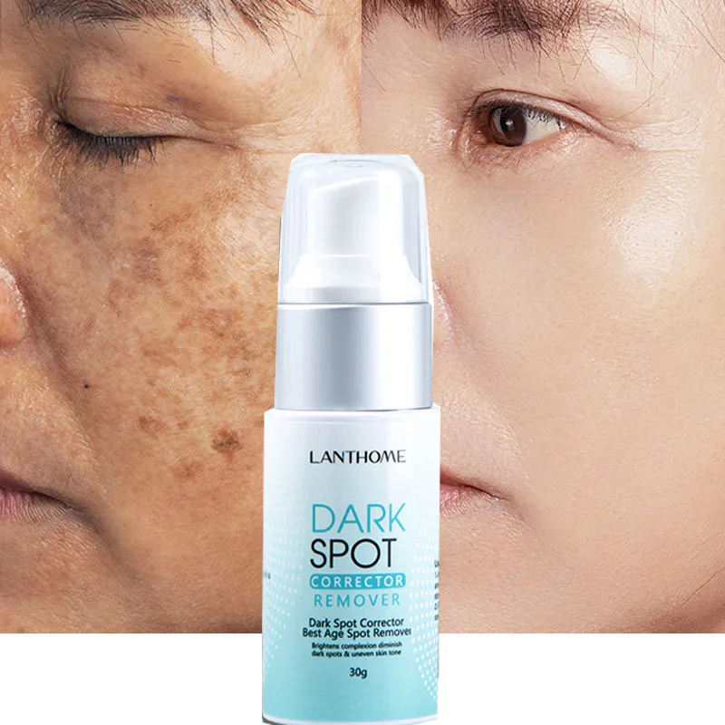 OEM 30g Natural Herbal blemish Serum Freckle Pimples Dark Spot Removal Corrector Eraser Whitening Cream