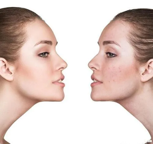 
Best peptide bfgf white powder for anti-wrinkle 