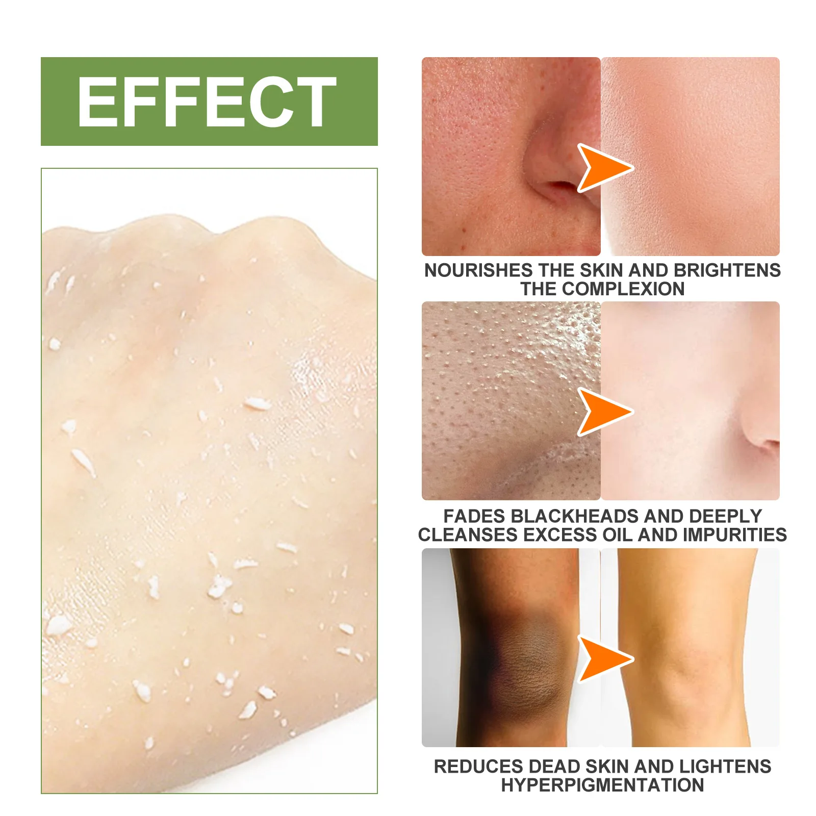private label oem custom logo  Acid Facial Exfoliating Gel Deep clear pores blackheads Acne Whitening Skin Gel