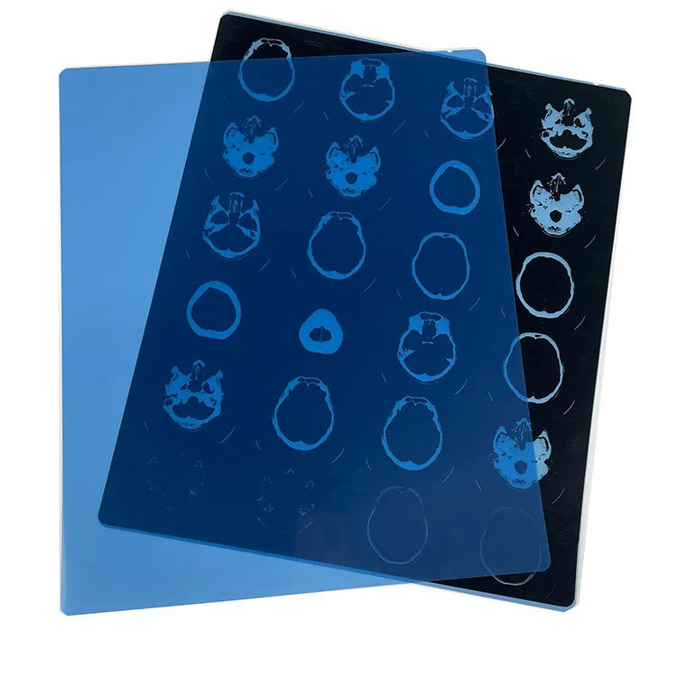 Fuji medical thermal dry film PET material suitable printing image output from CR/DR/CT/MRI