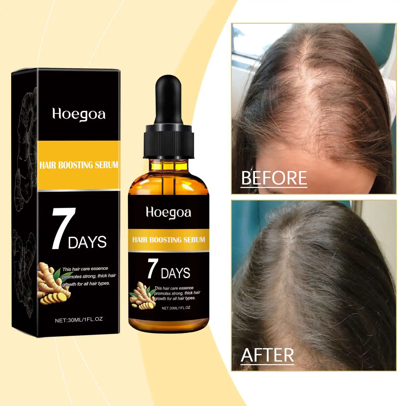 HOEGOA Wholesale Private Label Natural Ginger Hair Care Essence 7 Days Strengthen Thickening Hair Nutrient Solution Growth Oil