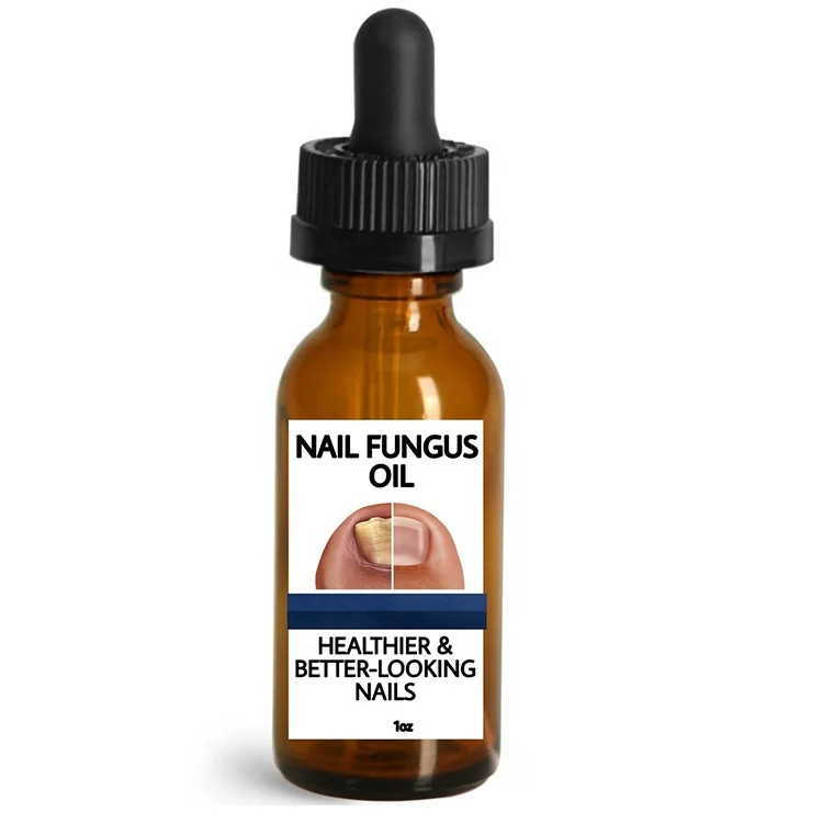 Customized Nail Fungus Oil Beautiful Healthy Nail Care Nail Fungal Treatment Serum for Hand Foot Removal Repair Gel