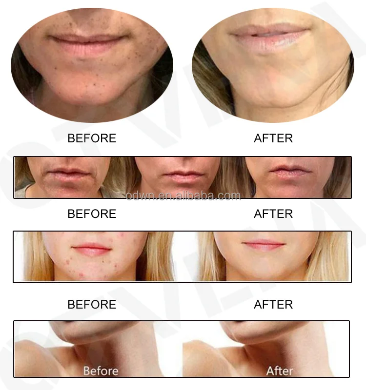 RTS Collagen Peptides Nourishing Repair Organic Lyophilized Powder Serum