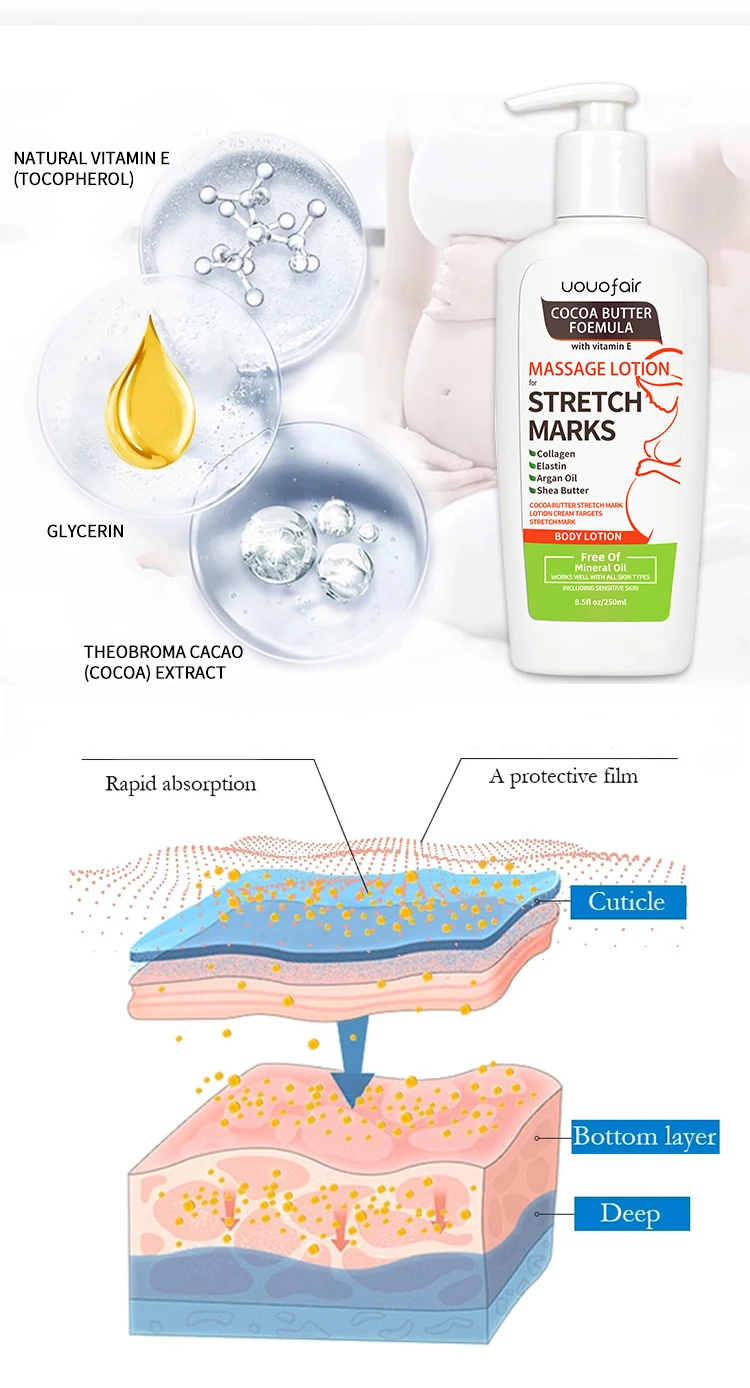 Manufacturer Free sample stretch marks removal cream