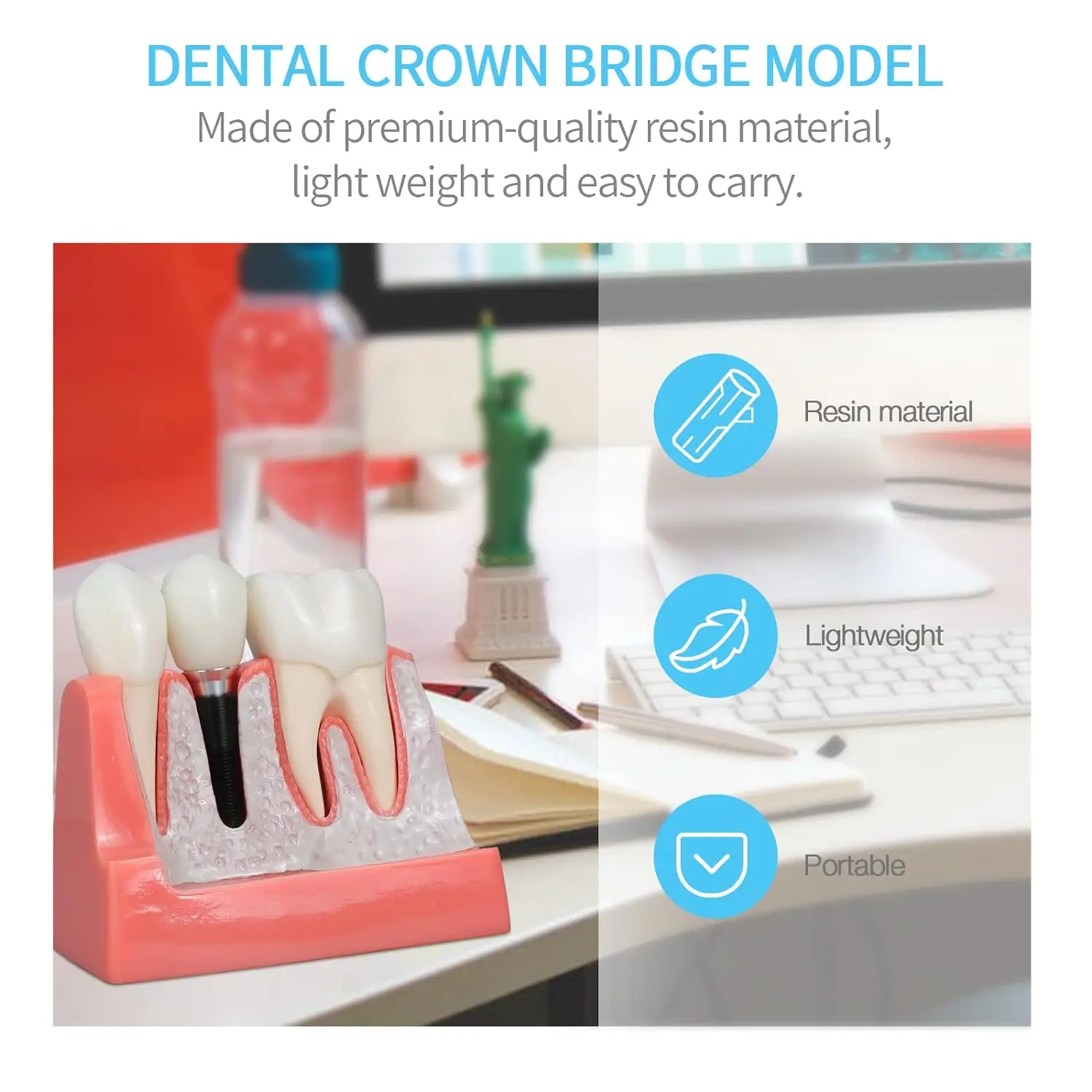 Dental Implant Model with Removable Analysis Crown Bridge Demonstration Teeth 4 Times for Medical Science Education Studying