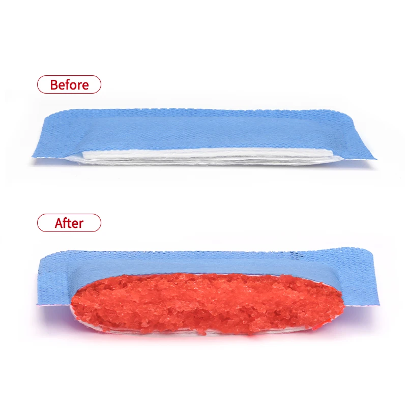 Alexer Super Absorbent Wound Dressing Non-Stick Gauze Pads, Wound Care Supplies for Pressure Ulcers, 1st/2nd Degree Burns