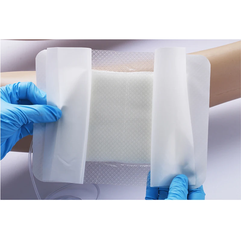 Single Use Negative pressure wound therapy VAC NPWT dressing kit white PVA foam with soft port for welsuc NPWT pump RH-140
