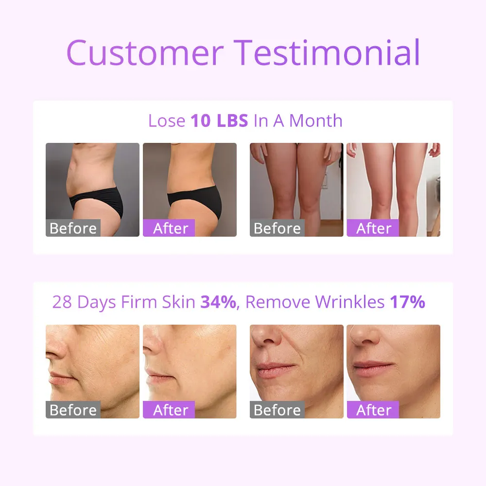 s shape 30k machine/colombian facelift machine/body contouring machine vacuum filter