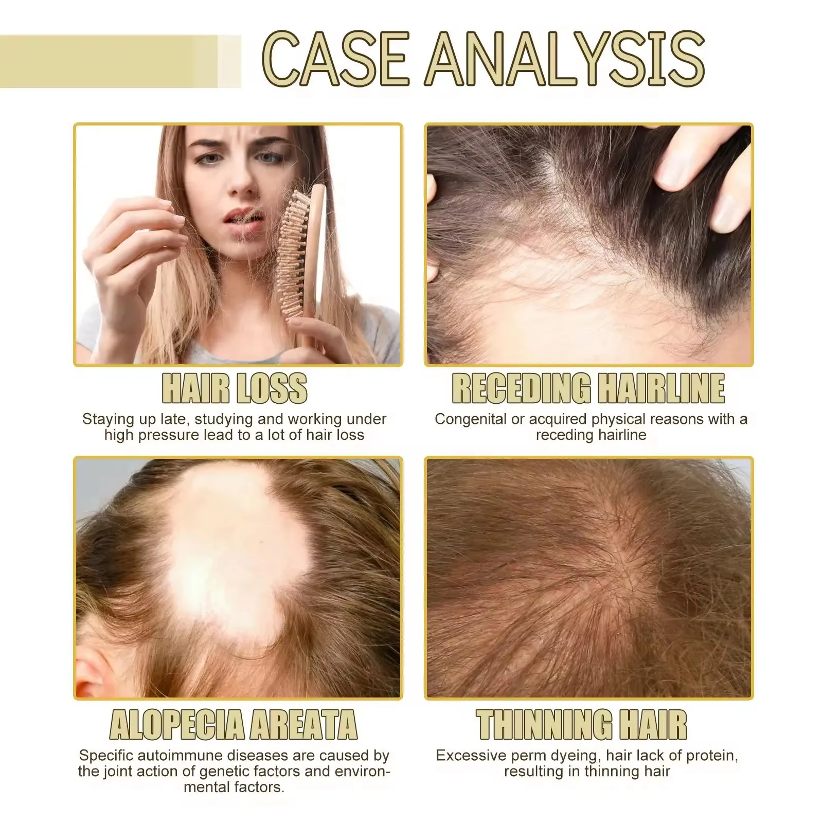Private Label Natural Biotin  Hair Growth Oil Hair Regrowth Treatment Scalp Care Massage Hair Scalp Oil