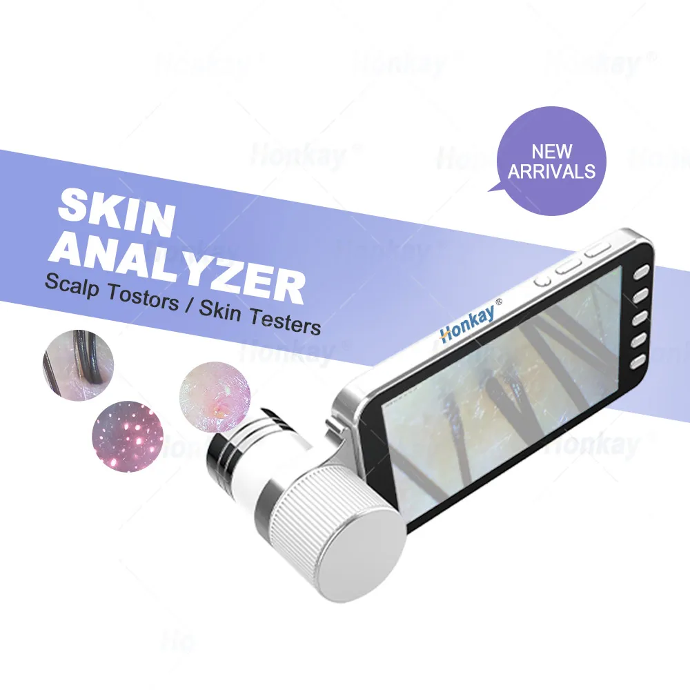 High-resolution 4k Imaging Hair Analyzer Hair Follicles Condition Analysis/Scalp Condition Scanner Detector