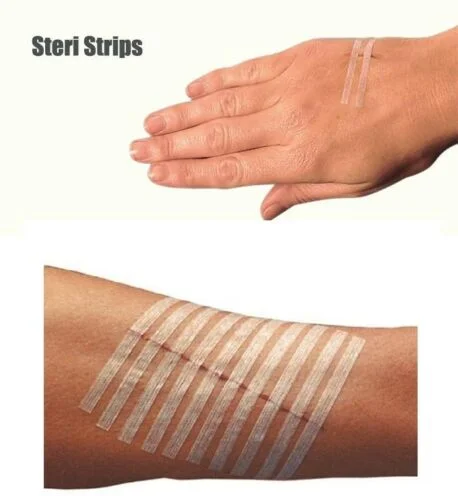 absorbent steri strip skin closure strips to close wound