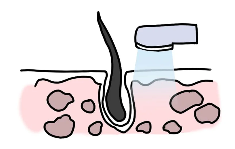 Инструмент для депиляции красоты лампа вспышка ipl Удаление волос интенсивный импульсный свет