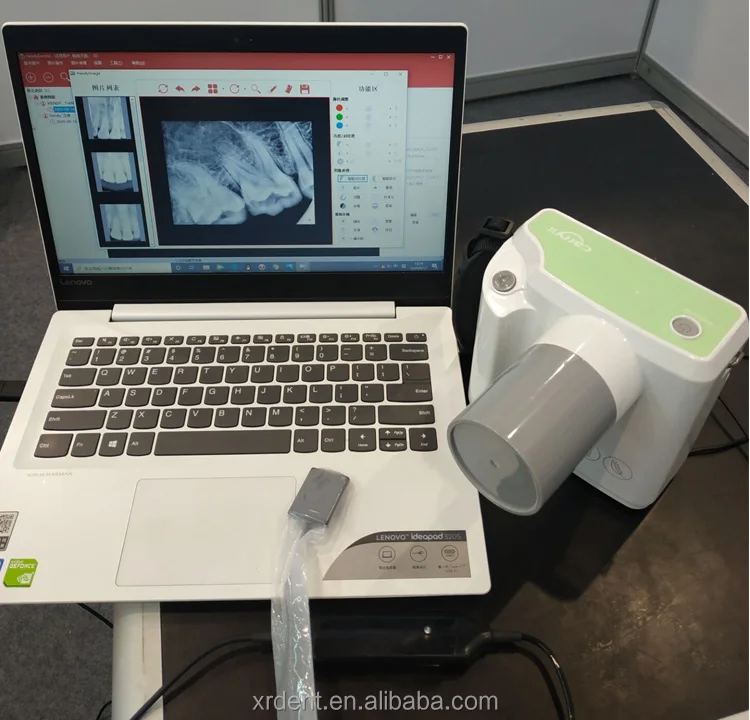 Dental-Xray-Portable_7.jpg