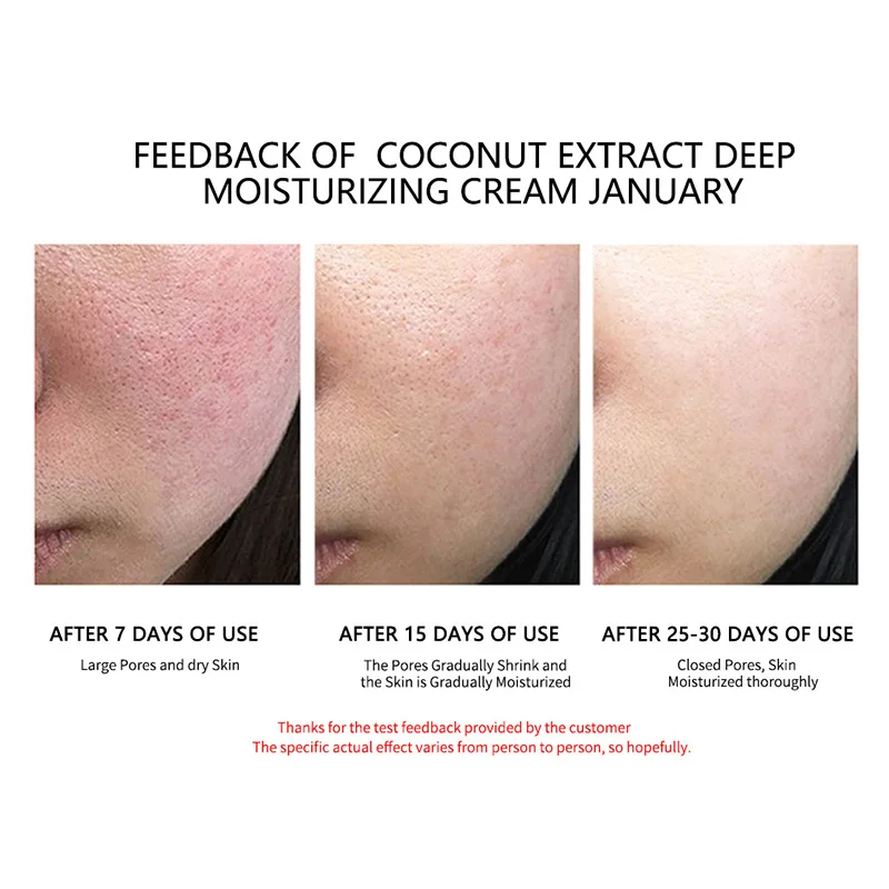 Wholesale Skin Care New Arrival MSLAM Coconut Deep Moisturizing Cream 80g For Face Repair Pores Hydrating