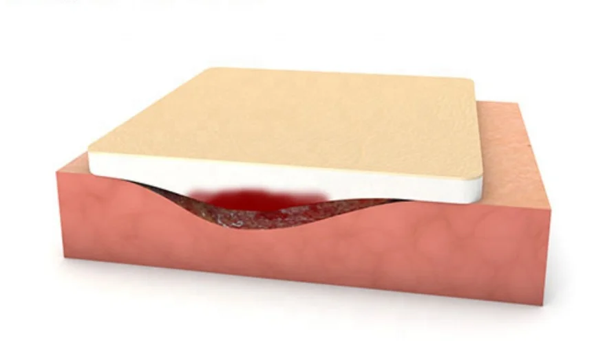 
Sterile pu foam dressing / Sterile adhesive Advanced Silicone Foam Wound Dressing 