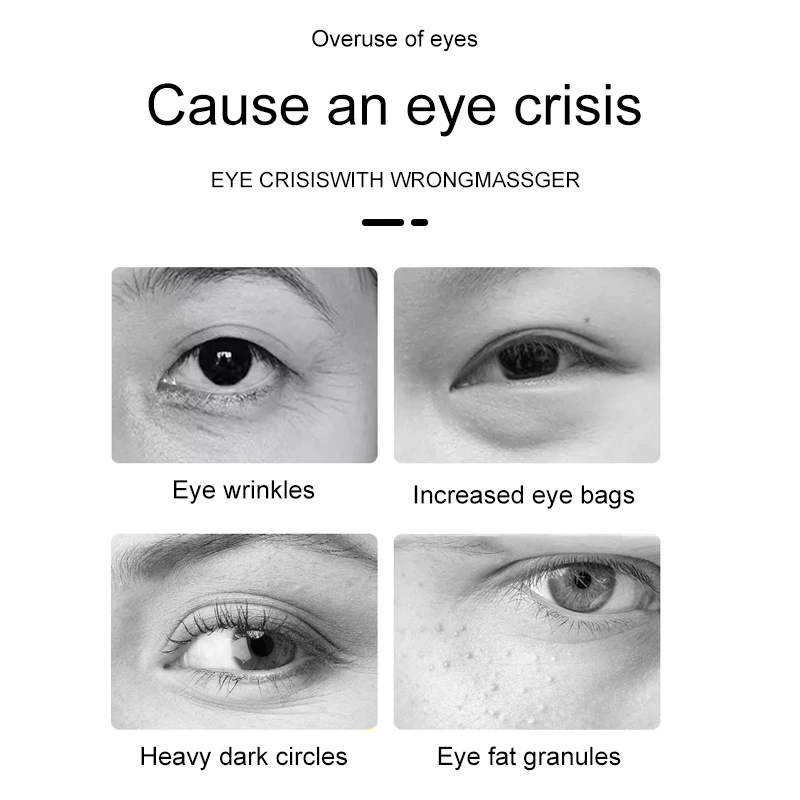 Best EMS Eye Care Massage Instrument RF Removeal Eye Fine Lines Relieve Eye Fatigue Beauty Instrument