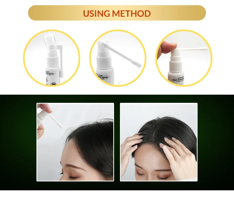 OMY LADY Hair Growth Spray Improve Prevent Hair Loss Products For Men Women